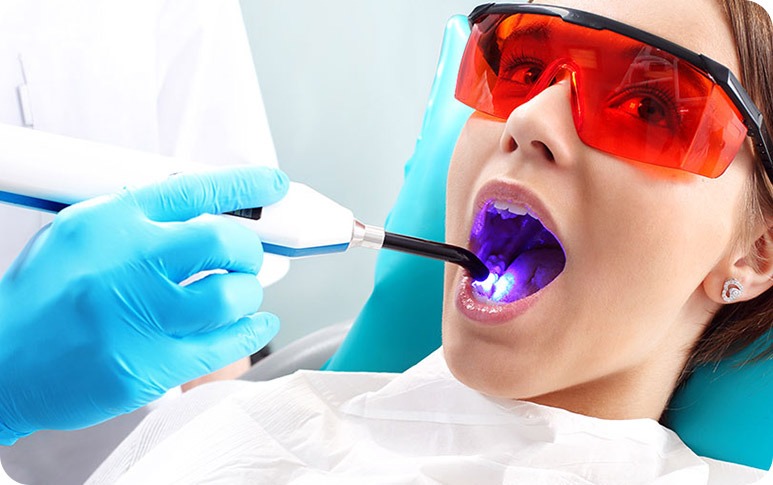 NE Calgary Cosmetic Dental Bonding | Redstone Smiles Dental | General and Family Dentist | NE Calgary Dentist