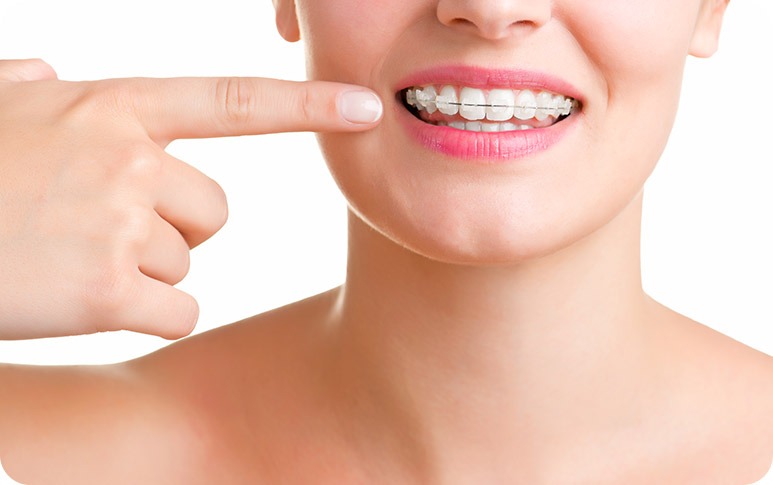 NE Calgary Metal Braces | Redstone Smiles Dental | General and Family Dentist | NE Calgary Dentist