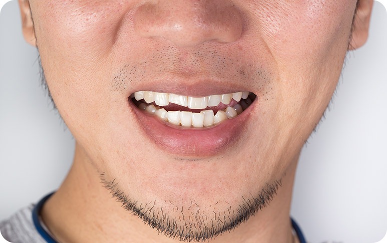 NE Calgary Orthodontics | Redstone Smiles Dental | General and Family Dentist | NE Calgary Dentist