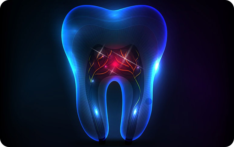 NE Calgary Root Canal Therapy | Redstone Smiles Dental | General and Family Dentist | NE Calgary