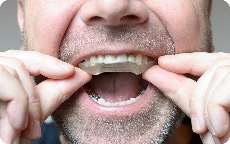 NE Calgary TMJ/TMD Therapy | Redstone Smiles Dental | General and Family Dentist | NE Calgary Dentist